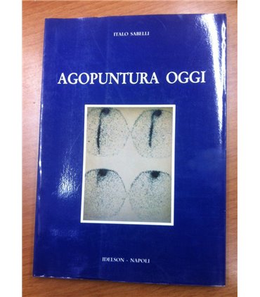 Agopuntura oggi